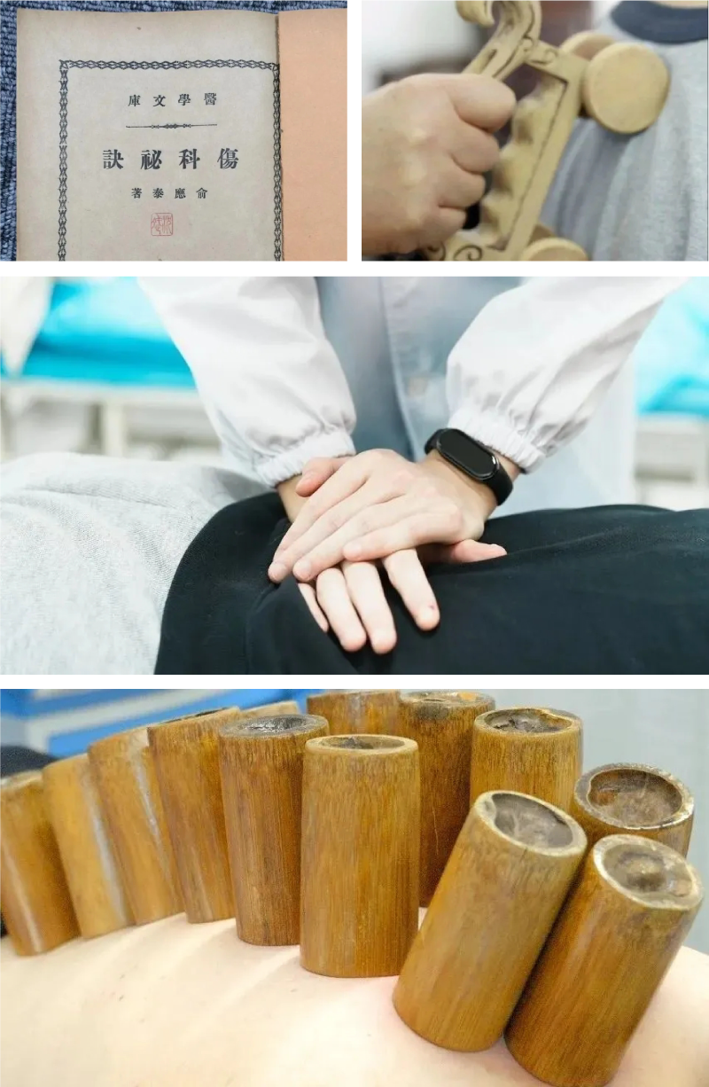 绍兴城东医院,非遗,张氏脊椎疗法